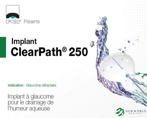 Vignette Plaquette Implant à glaucome ClearPath